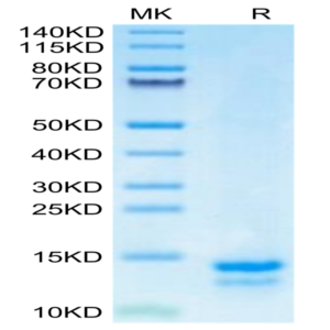 Human FAM19A5 Protein (FAM-HE1A5)