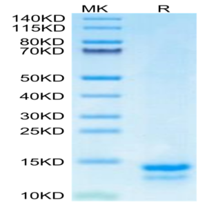 Mouse FAM19A5 Protein (FAM-ME1A5)