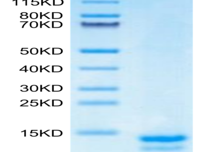 Mouse FAM19A5 Protein (FAM-ME1A5)