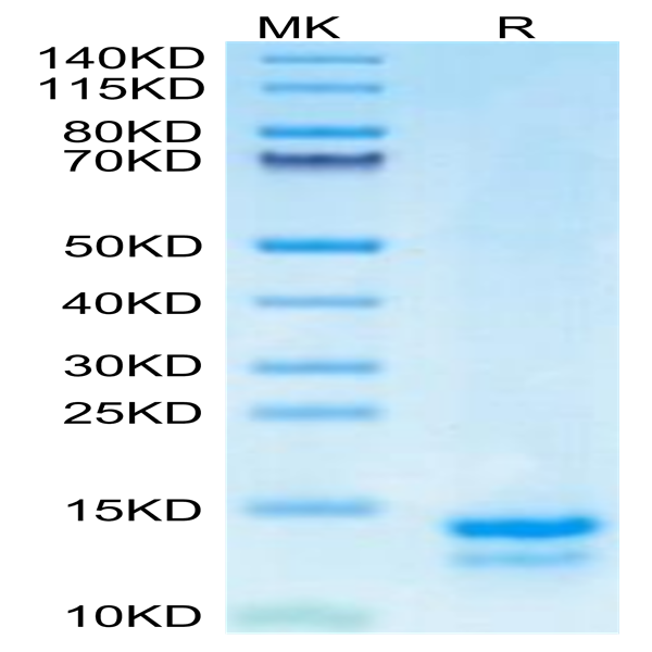 Mouse FAM19A5 Protein (FAM-ME1A5) Mouse FAM19A5 Protein (FAM-ME1A5)