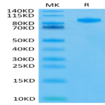Human FAP Protein (FAP-HM101)