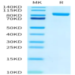 Biotinylated Human FAP Protein (FAP-HM401B)