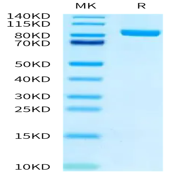 Biotinylated Human FAP Protein (FAP-HM401B)
