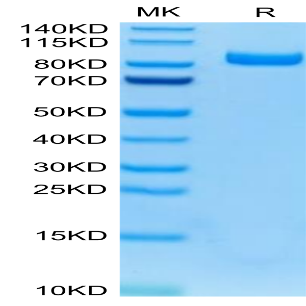 Mouse FAP Protein (FAP-MM101)
