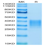 Human Fas/TNFRSF6/CD95 Protein (FAS-HM101)