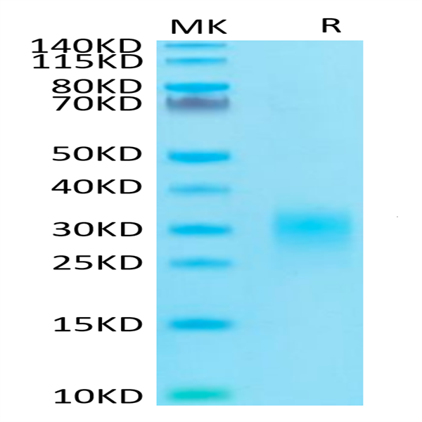 Human Fas Ligand/TNFSF6 Protein (FAS-HM10L)
