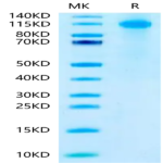 Biotinylated Human FcRH5/FcRL5 Protein (Primary Amine Labeling) (FCR-HM101B)