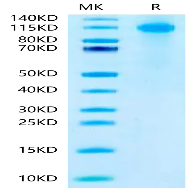Biotinylated Human FcRH5/FcRL5 Protein (Primary Amine Labeling) (FCR-HM101B)