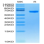 Human FCRL2/IRTA4 Protein (FCR-HM102)