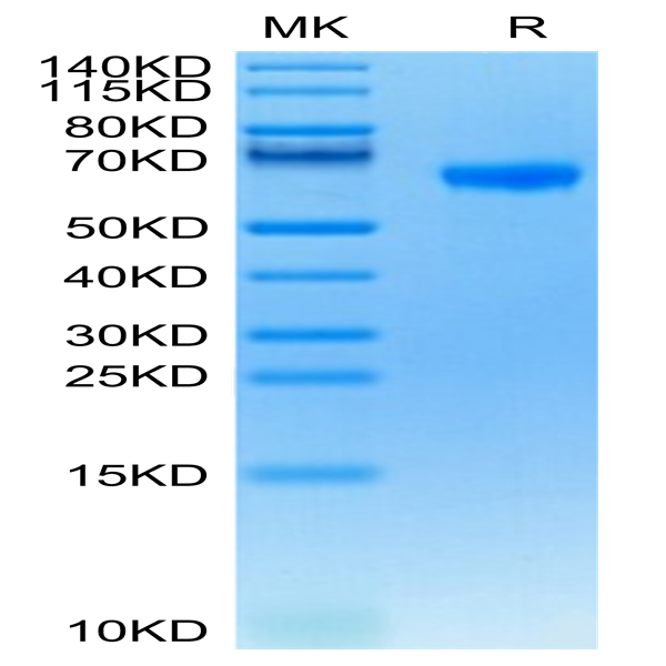 Human FCRL2/IRTA4 Protein (FCR-HM102)