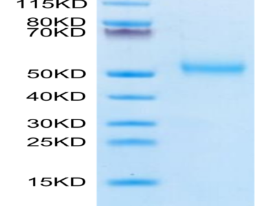 Human FcRH6/FCRL6 Protein (FCR-HM106)