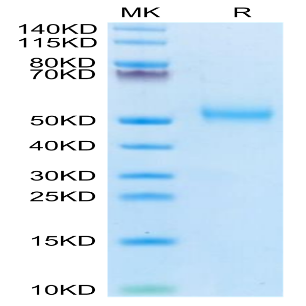 Human FcRH6/FCRL6 Protein (FCR-HM106) Human FcRH6/FCRL6 Protein (FCR-HM106)