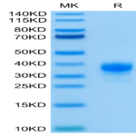 Human Fc gamma RIIA/CD32a (R167) Protein (FCR-HM42A)