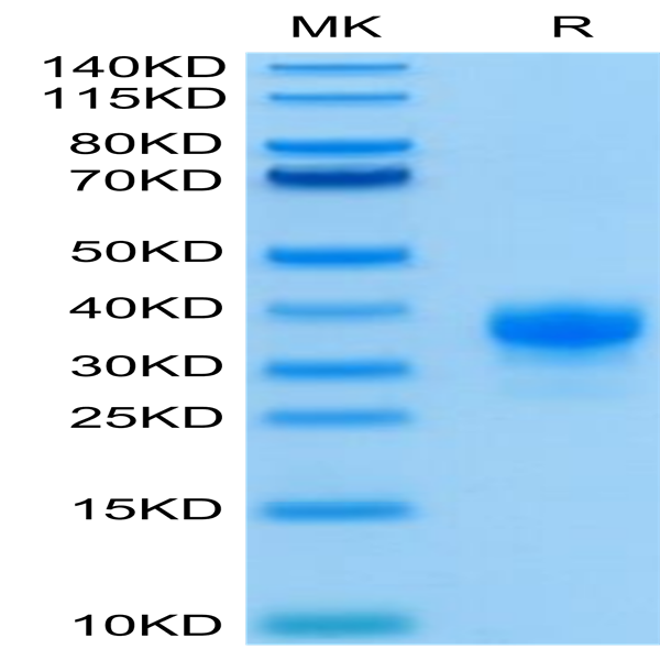 Human Fc gamma RIIA/CD32a (R167) Protein (FCR-HM42A)