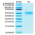 Biotinylated Human Fc gamma RIIIB/CD16b (NA2) Protein (FCR-HM42BB)