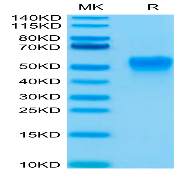 Biotinylated Human Fc gamma RIIIA/CD16a (V176) Protein (FCR-HM43AB)