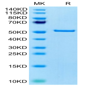 Human FNDC1 Protein (FDC-HE101)