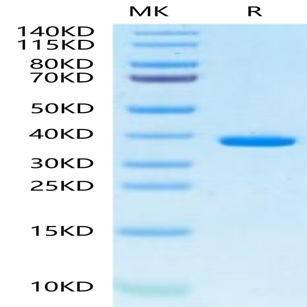 Human FDPS Protein (FDS-HE001)