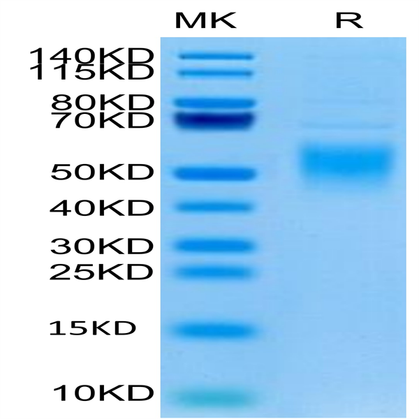 Human Fc epsilon RI alpha/FCER1a Protein (FER-HM101)
