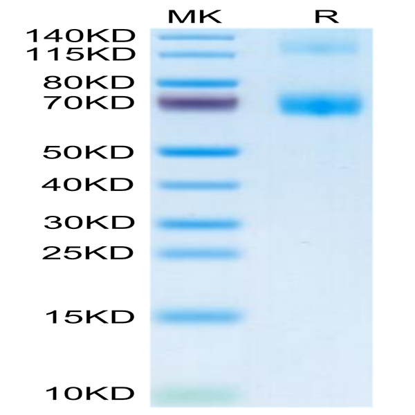 Mouse Fc Epsilon RI alpha/FCER1a Protein (FER-MM201)