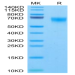 Rhesus macaque FGFR4 Protein (FGF-CM1R4)