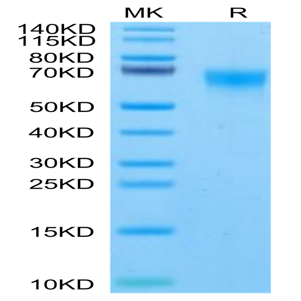 Rhesus macaque FGFR4 Protein (FGF-CM1R4)
