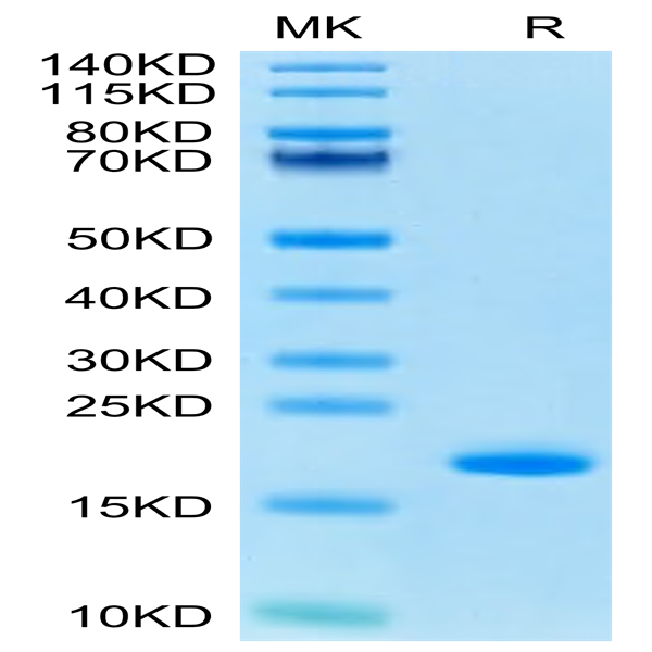 Human FGF basic (154aa) Protein (FGF-HE002)