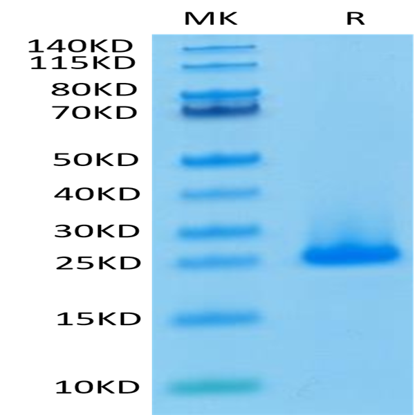 Human FGF10 Protein (FGF-HE010)