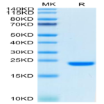 Biotinylated Human FGF10 Protein (Primary Amine Labeling) (FGF-HE010B)