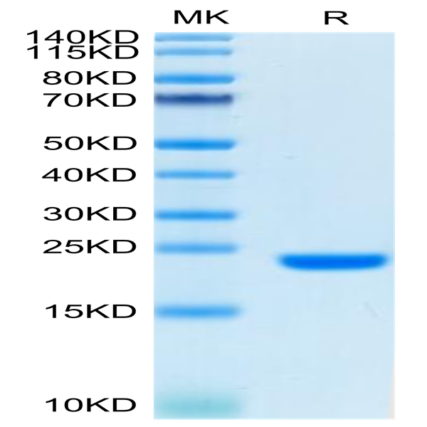 Biotinylated Human FGF10 Protein (Primary Amine Labeling) (FGF-HE010B)
