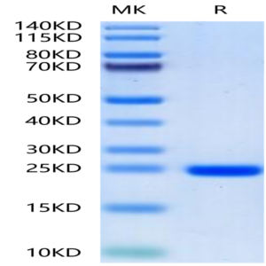 Human FGF8a Protein (FGF-HE08A)