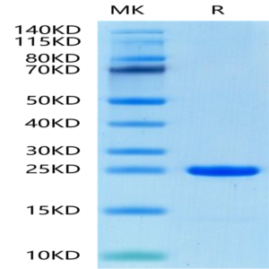 Human FGF8b Protein (FGF-HE08B)
