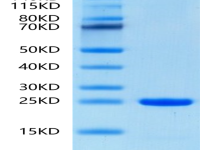 Human FGF8b Protein (FGF-HE08B)