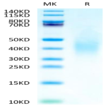 Human FGFR2 beta (IIIb) Domain Protein (FGF-HM0BD)