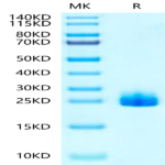 Hamster FGF21 Protein (FGF-HM12T)