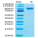 Human FGFR4 Protein (FGF-HM2R4)