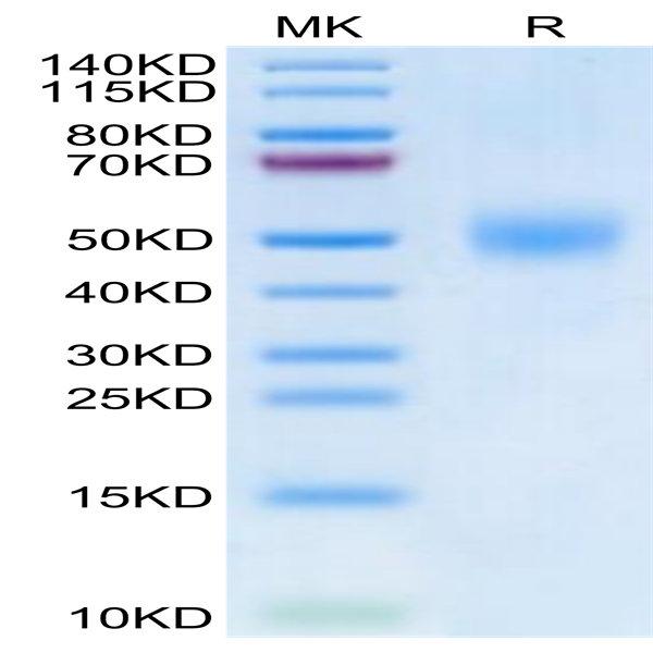 Biotinylated Human FGFR1 beta (IIIc) Protein (FGF-HM41CB)