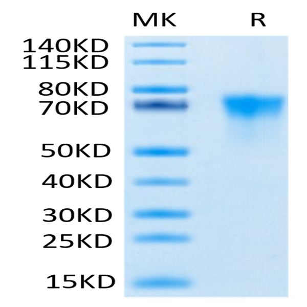 Human FGFR3 alpha (IIIb) Protein (FGF-HM43B)
