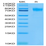 Biotinylated Human FGFR2 alpha (IIIb) Protein (FGF-HM4ABB)