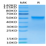 Human FGFR3 beta (IIIc) Protein (FGF-HM4BC)