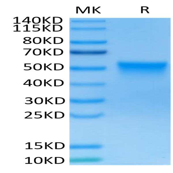Human FGFR3 beta (IIIc) Protein (FGF-HM4BC)