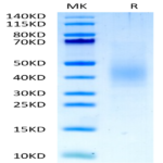 Biotinylated Human FGFR2 beta (IIIb) Domain Protein (FGF-HM4BDB)