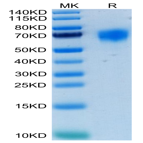 Human FGFR4 Protein (FGF-HM4R4)