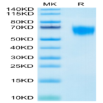 Biotinylated Human FGFR4 Protein (FGF-HM4R4B)