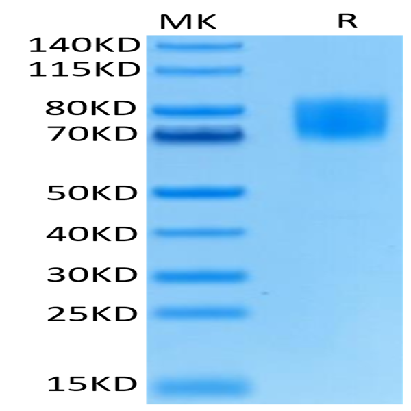 Biotinylated Human FGFR1 alpha (IIIc) Protein (FGF-HM4RAB)