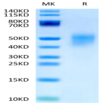 Human FGFR4 beta Protein (FGF-HM4RB)