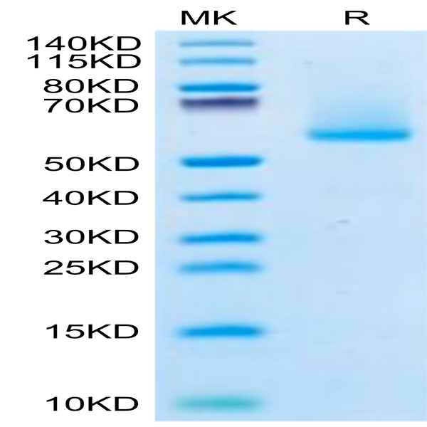 Biotinylated Human FGF21 Protein (FGF-HM621B)