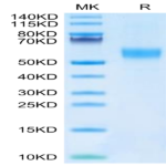 Mouse FGFR3 alpha (IIIb) Protein (FGF-MM43B)