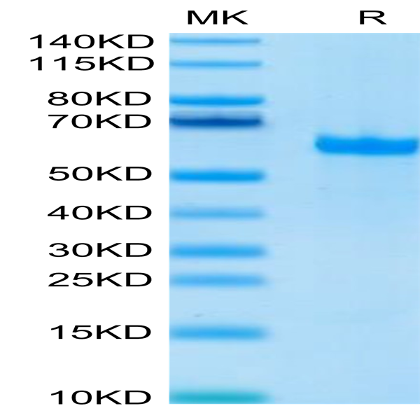 Human FGL1 Protein (FGL-HM211)
