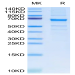 Human FGL2 Protein (FGL-HM212)